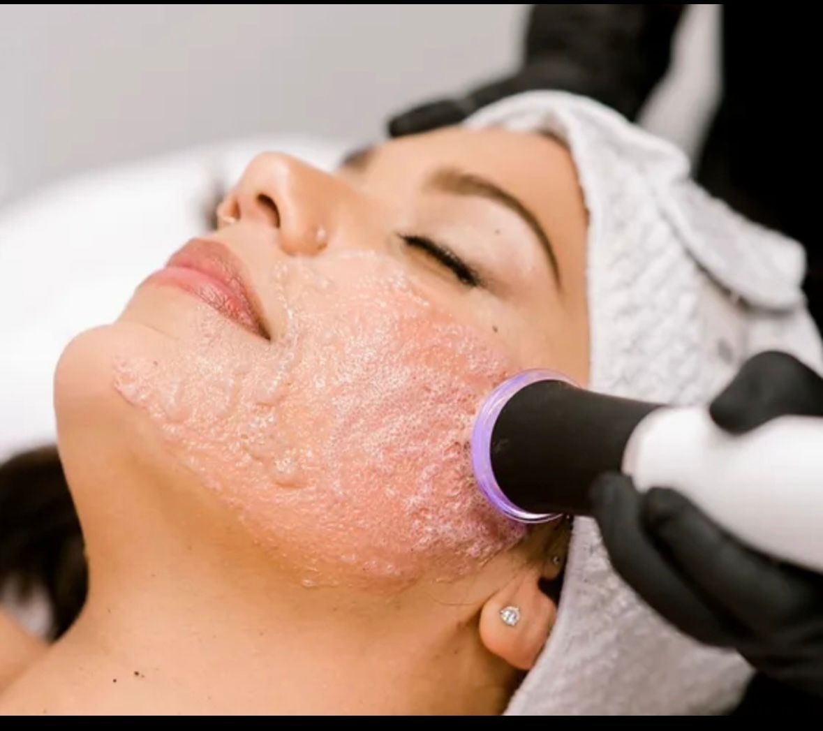 Geneo Facial